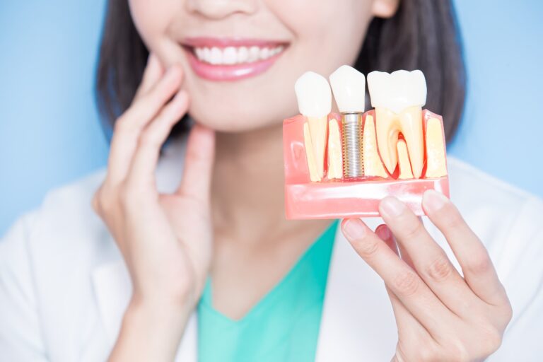 Can Dental Implants Last a Lifetime?