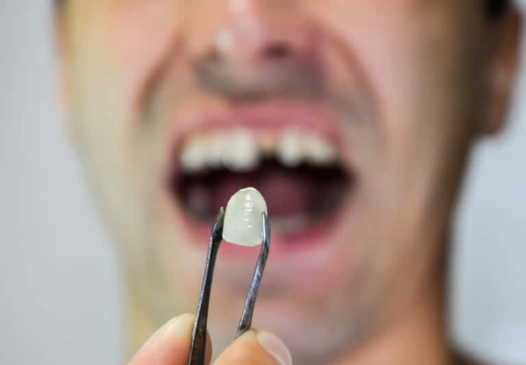 Replace Your Missing Teeth scaled