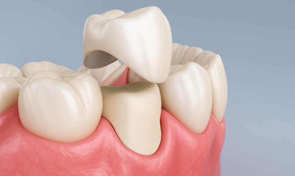 Cutting-Edge Restorative Dental Treatments Transforming Oral Health in Pacific Beach, San Diego