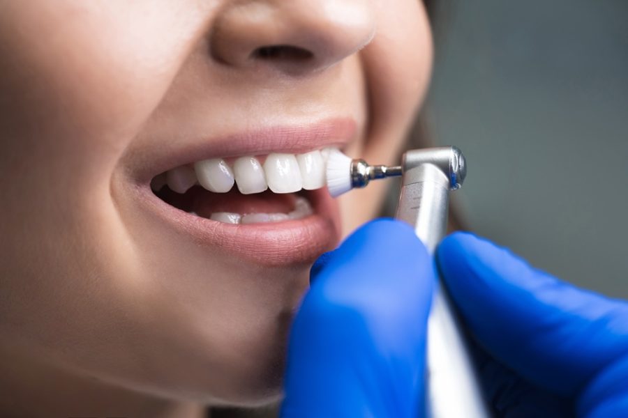 Dental hygienist polishing a patient’s teeth with a professional dental tool during a routine cleaning appointment – how long does a dentist clean take